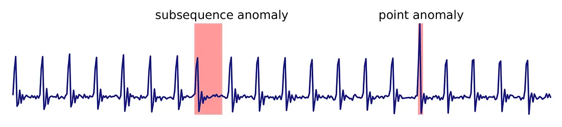 Illustration of time series anomaly detection